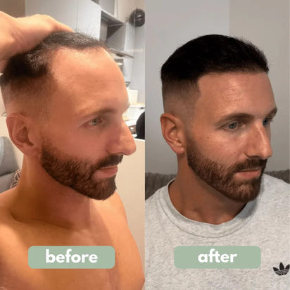 Hair Growth Roll-On Serum