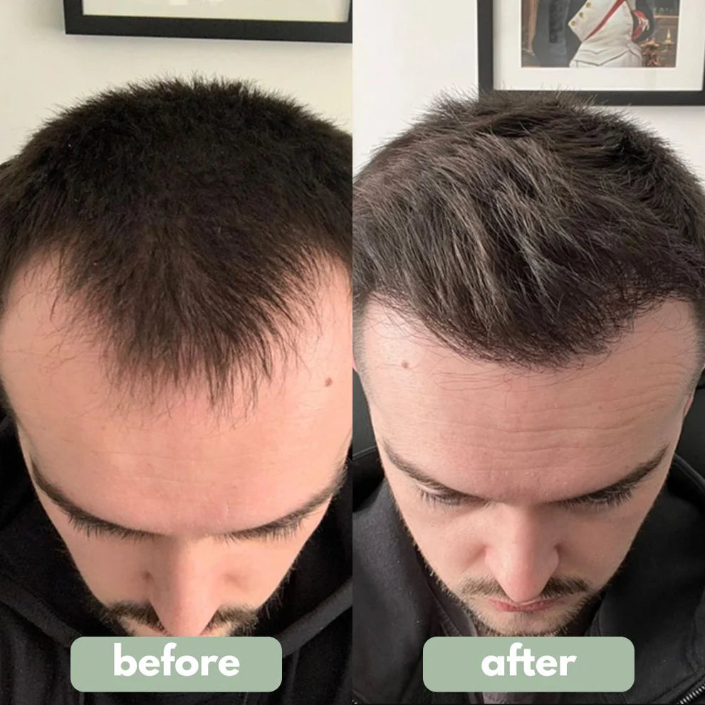 Hair Growth Roll-On Serum